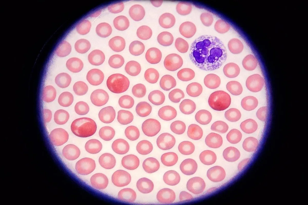 ανασκόπηση αναφοράς εξετάσεων αίματος με κλινική εποπτεία και υποστήριξη ερμηνείας με AI