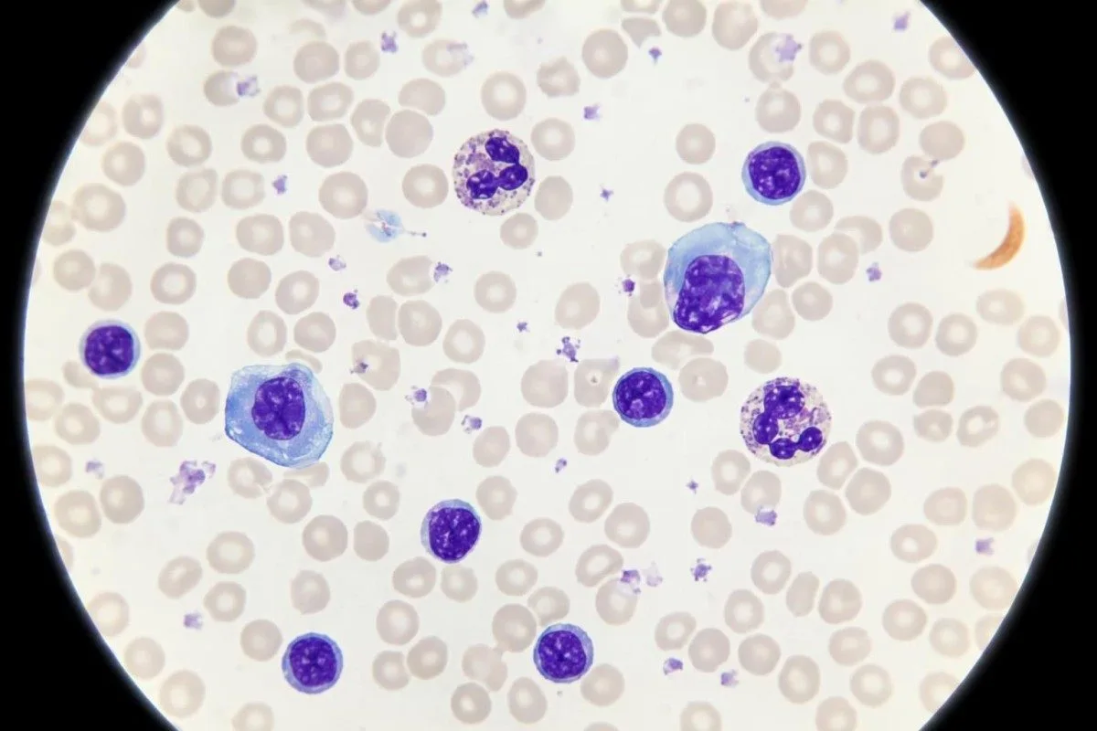 kifaa cha kiotomatiki cha hematolojia kinachotumika kupima lymphocyte na tofauti kamili ya CBC