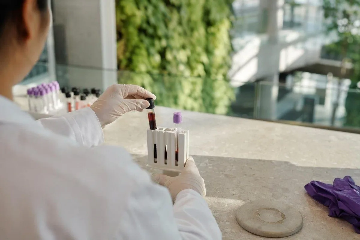 එක් දර්ශනයක ESR ටියුබය සහ CRP සාම්පලය සමඟ සංසන්දනය කරන ලද රසායනාගාර සලකුණු දෙකක්