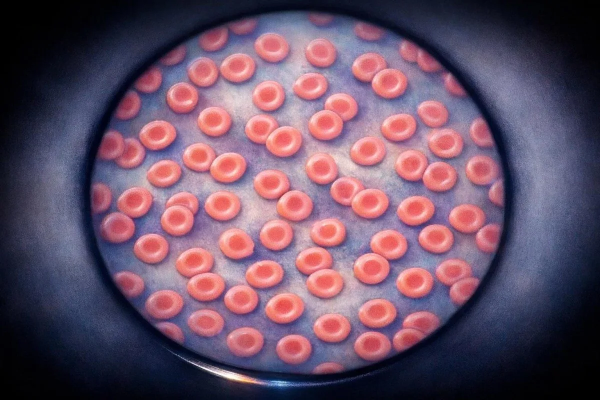 Przygotowanie pacjenta do porannych wyników badań w ramach prawidłowego zakresu żelaza z uwzględnieniem pory przyjmowania suplementów