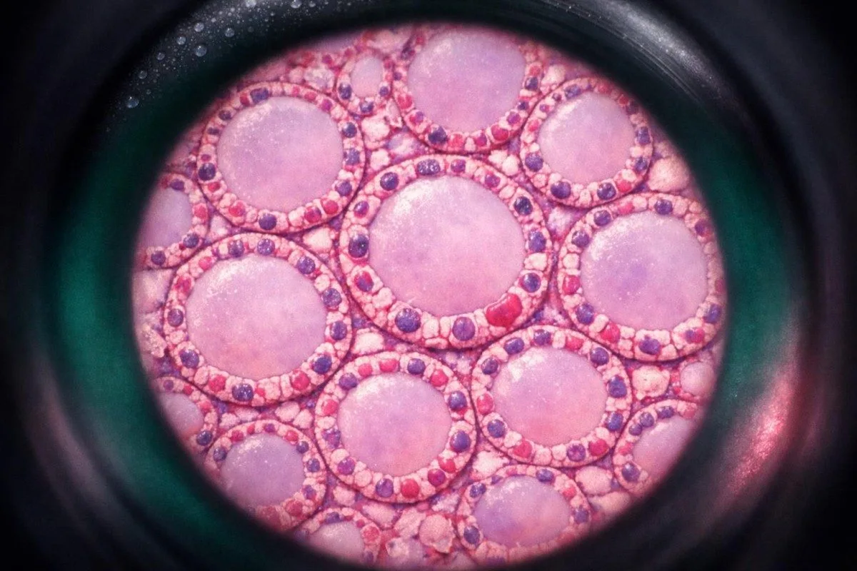 Thyroid follicular cells under microscope linked to TSH normal range interpretation in children