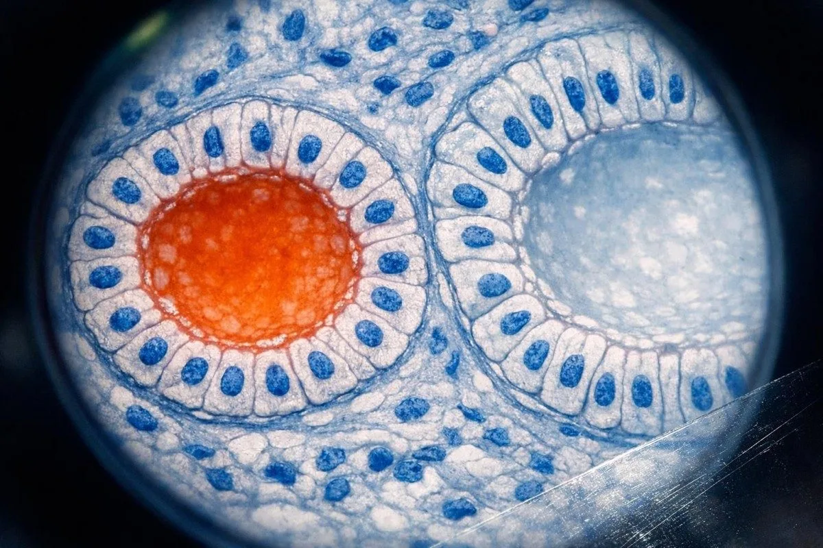 Revizuire asistată de AI a BUN împreună cu creatinina, eGFR, sodiul, potasiul și tendințele anterioare