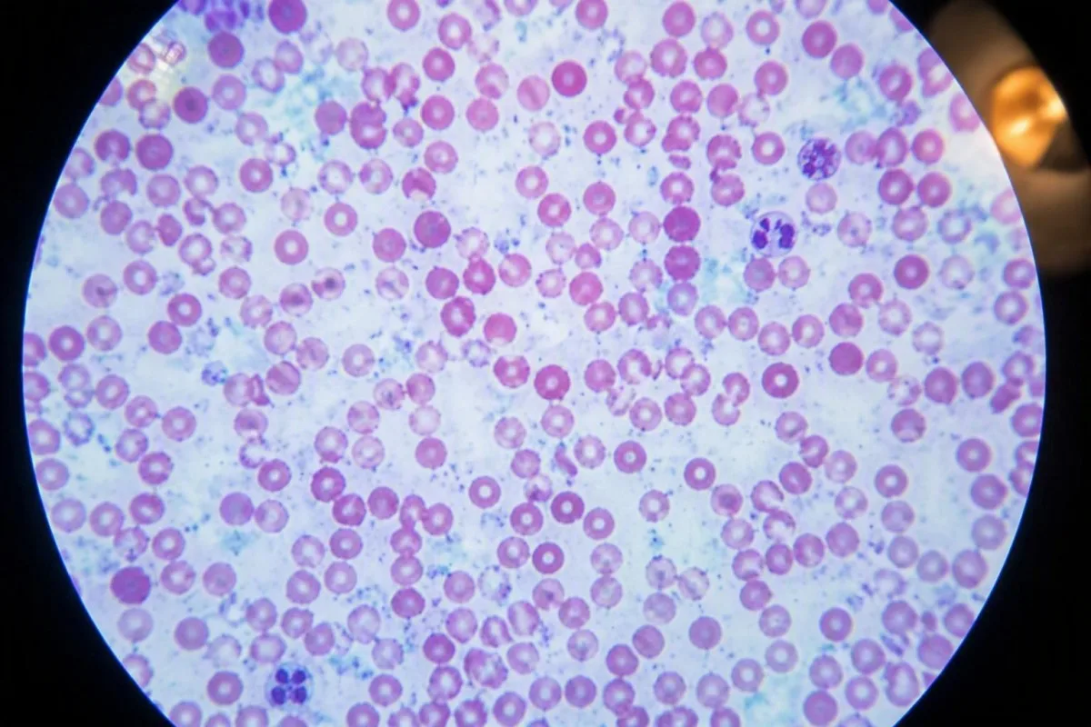 Glutathione Blood Test: Plasma vs RBC Results