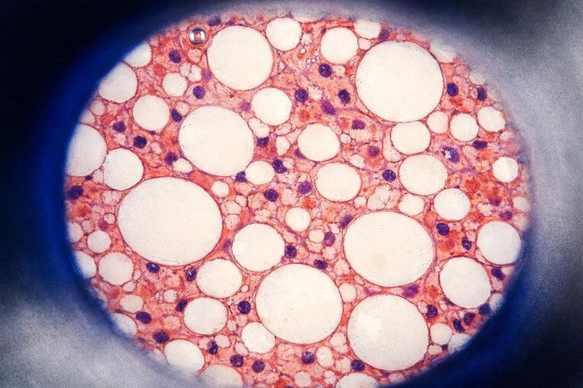 วัสดุสำหรับการตรวจสอบความถูกต้องของการทดสอบไขมัน (lipid assay) และซีรั่มอ้างอิงที่ใช้ในการวิจัยและการทบทวนคุณภาพ