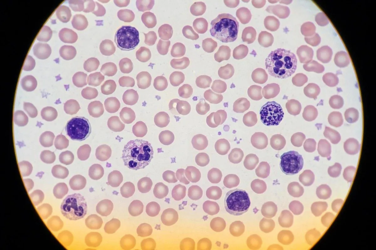 Slaid sampel sel yang menunjukkan sel darah merah, sel darah putih dan platelet untuk semakan CBC pra-op