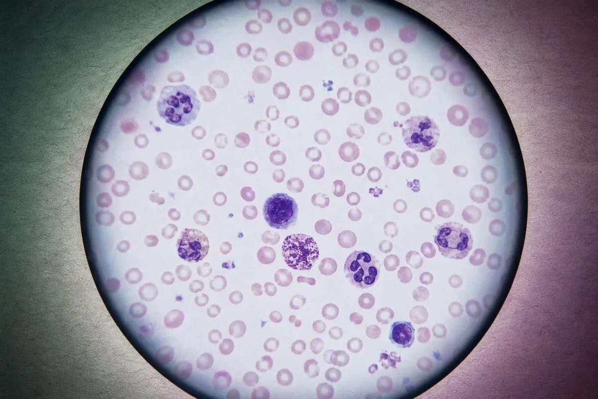 Immunoassay-analyseapparat, der behandler prolaktintest for udeblevne menstruationer i perimenopause