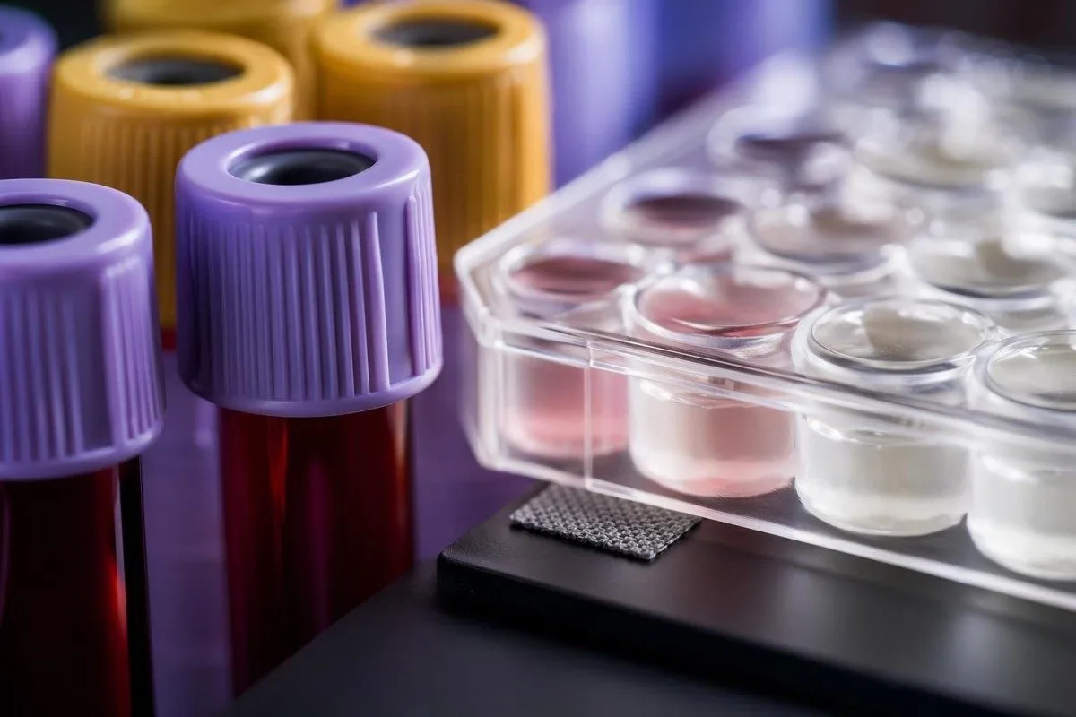Klinikinis makro vaizdas laboratorinių mėginių, naudojamų galvos skausmų kraujo tyrimų tyrimams