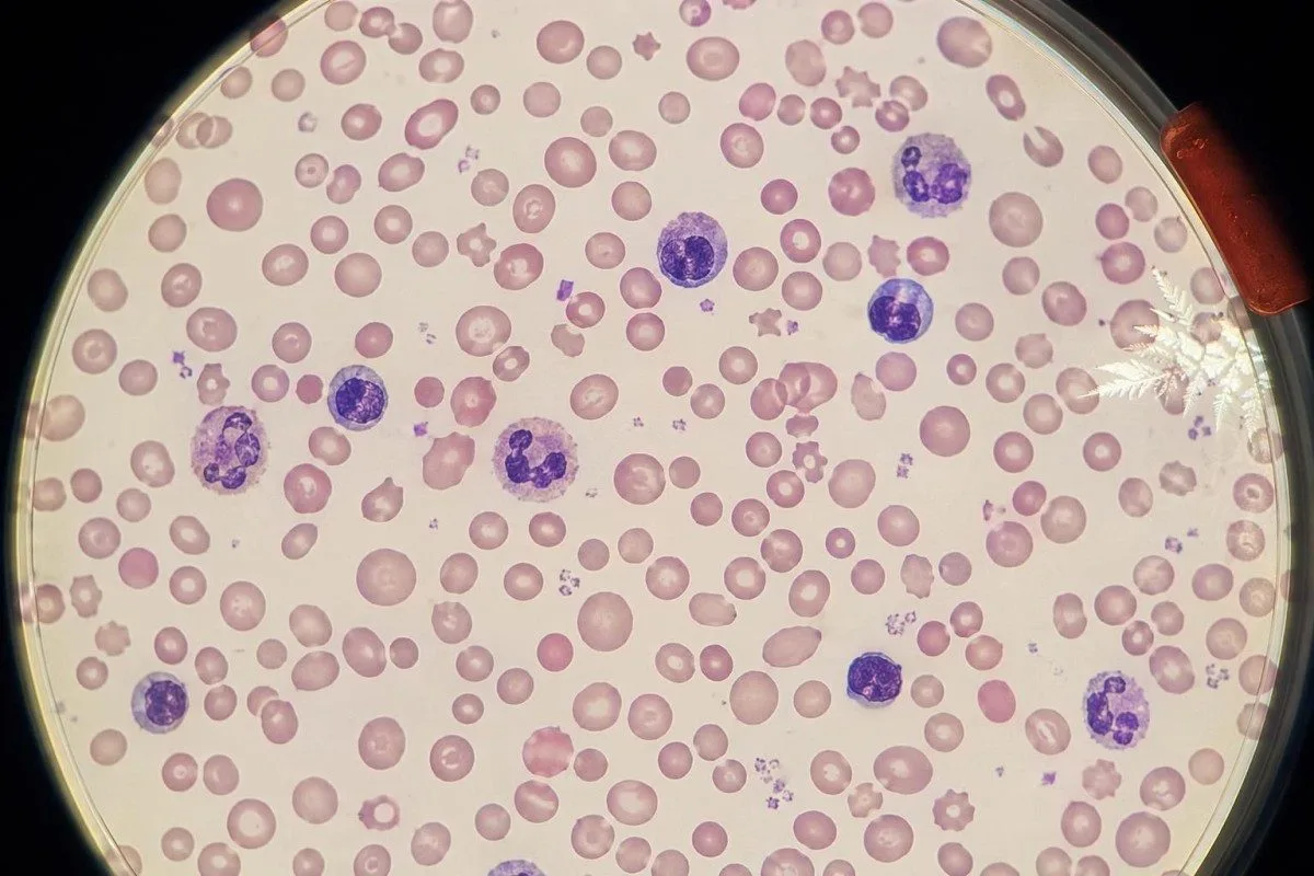 Risultati delle analisi del sangue in giornata caricati come PDF per l’interpretazione con IA con validazione clinica