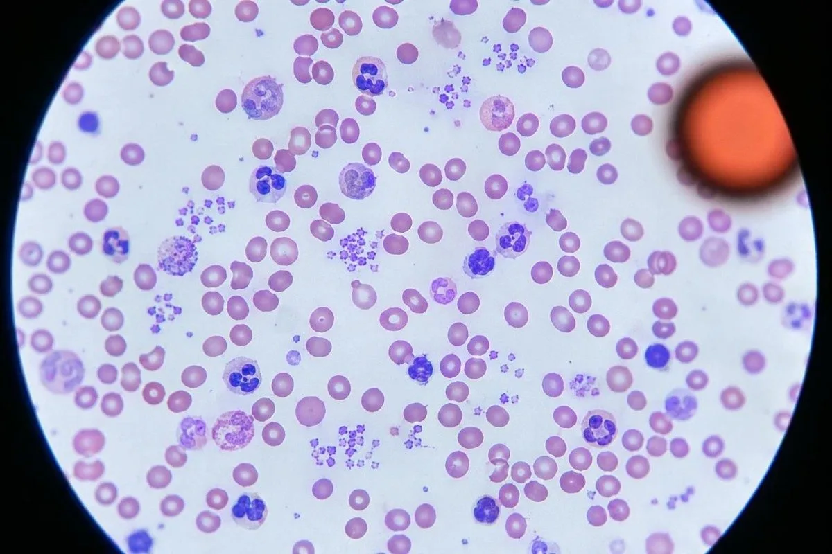 Il clinico esamina le analisi del sangue per la perdita di peso e i prossimi passi in nutrizione