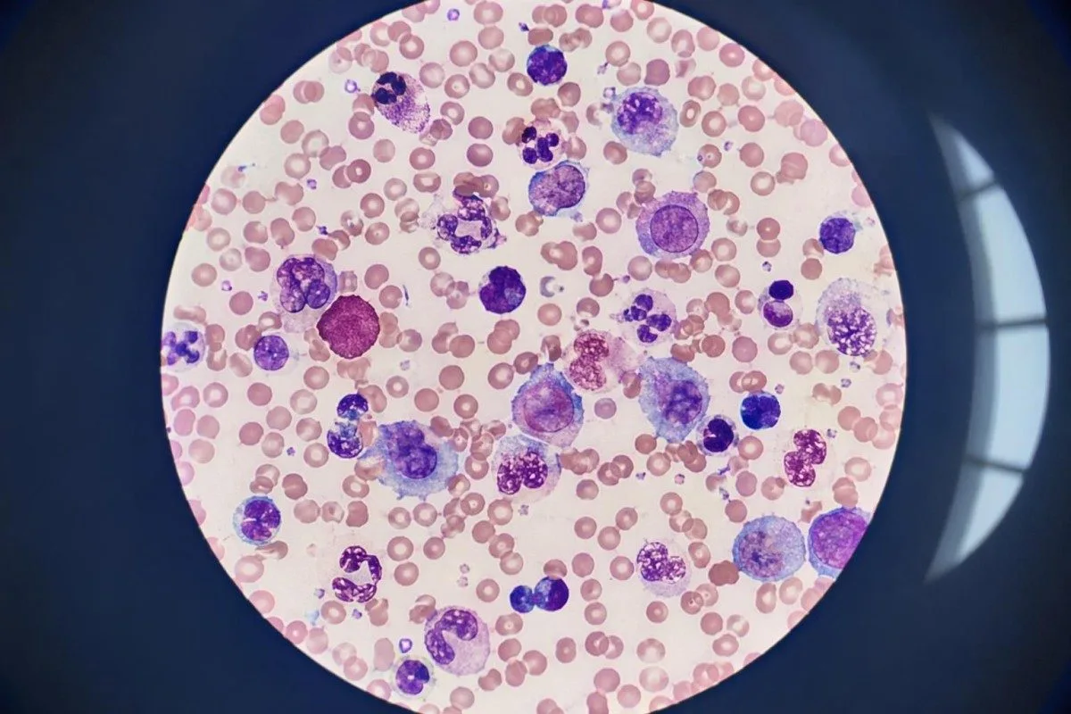 تم إعداد رفع ملف PDF لنتائج LabCorp على مكتب سريري آمن دون نص مقروء