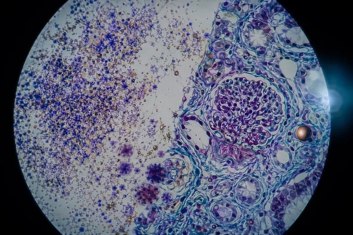 portaobxectos de mostra da proba de sangue de p-tau que mostra interferencia do ensaio e contexto de función renal