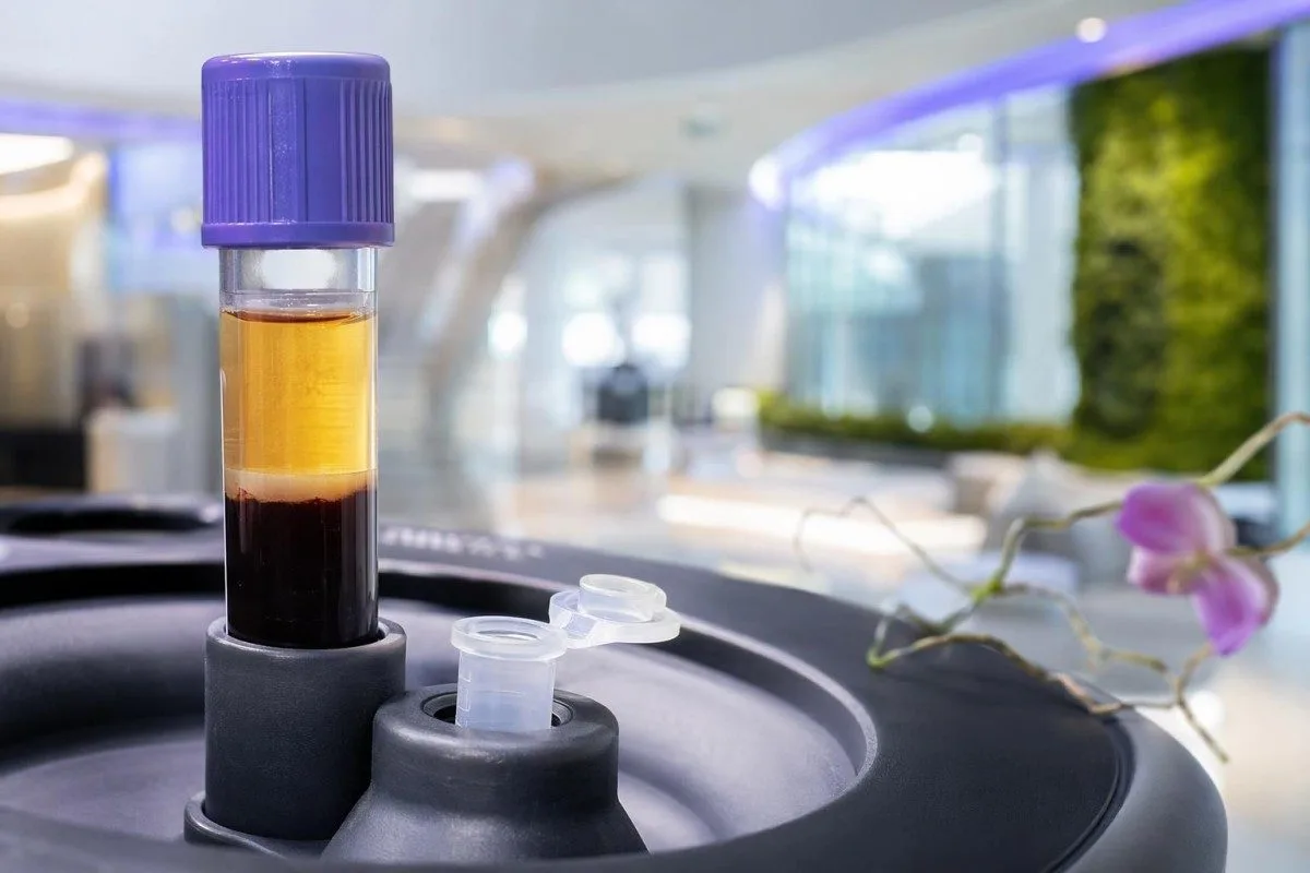 Analisi sierica per esame del sangue per MST con apparecchiature di immunodosaggio in un laboratorio clinico moderno