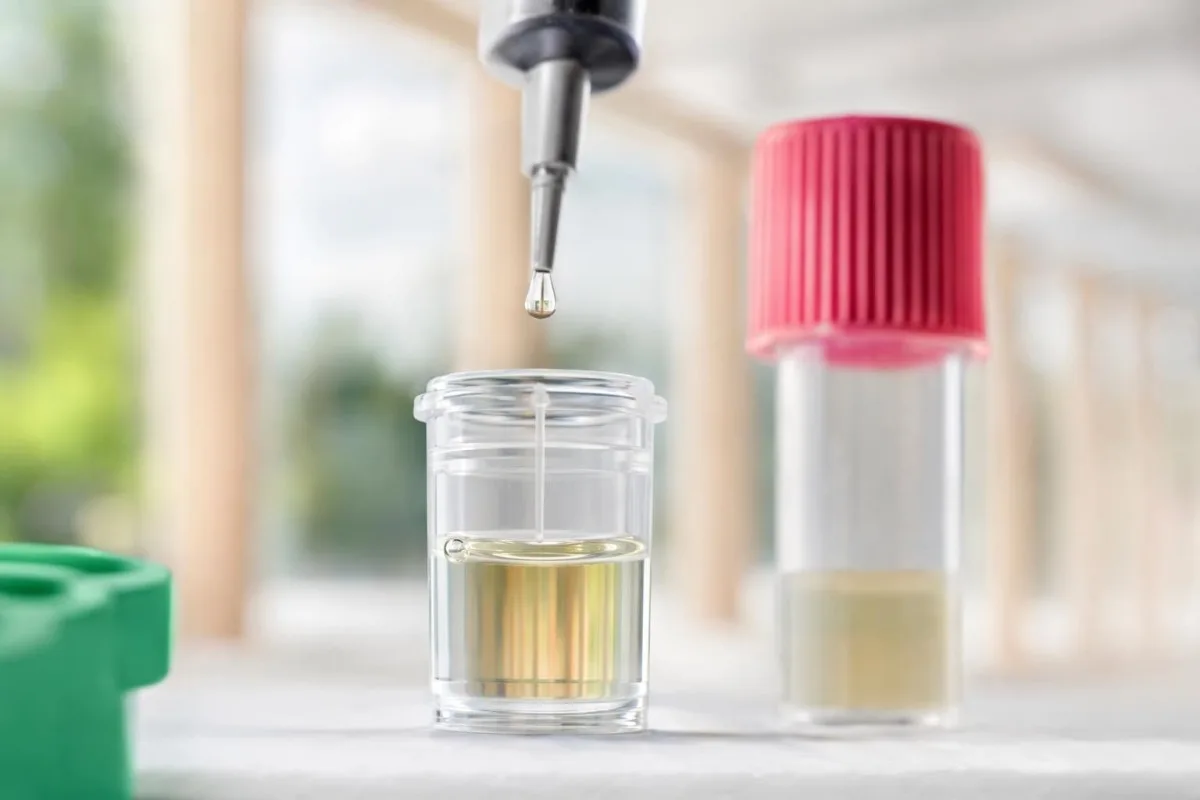 سیلائن اور گردوں کی حفاظت کے جائزے کے ذریعے Aldosterone test کی کنفرمیشن پاتھ وے