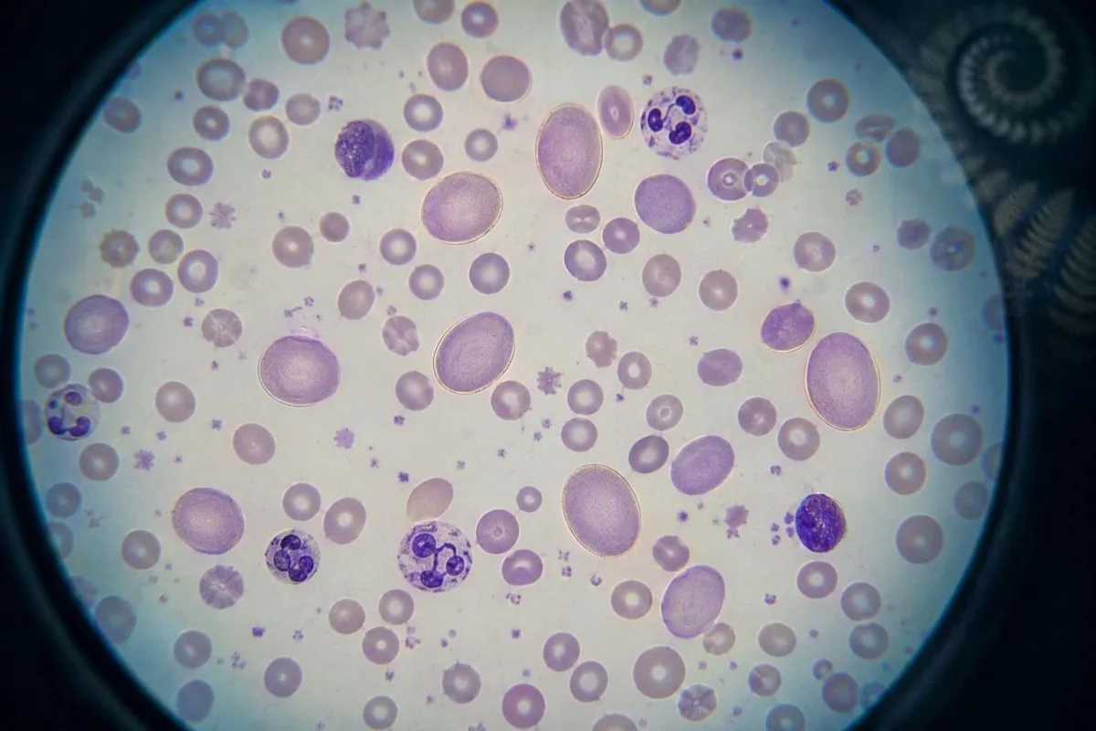 Laboratorijski mrtva priroda koja prikazuje B12, gastrin, pepsinogen i tok rada za autoimuno testiranje