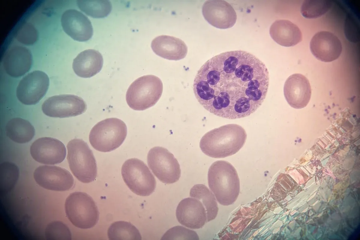 Neurologisch onderscheid bij vitamine B12 versus folaat geïllustreerd met een model van perifere zenuw en ruggenmergroute