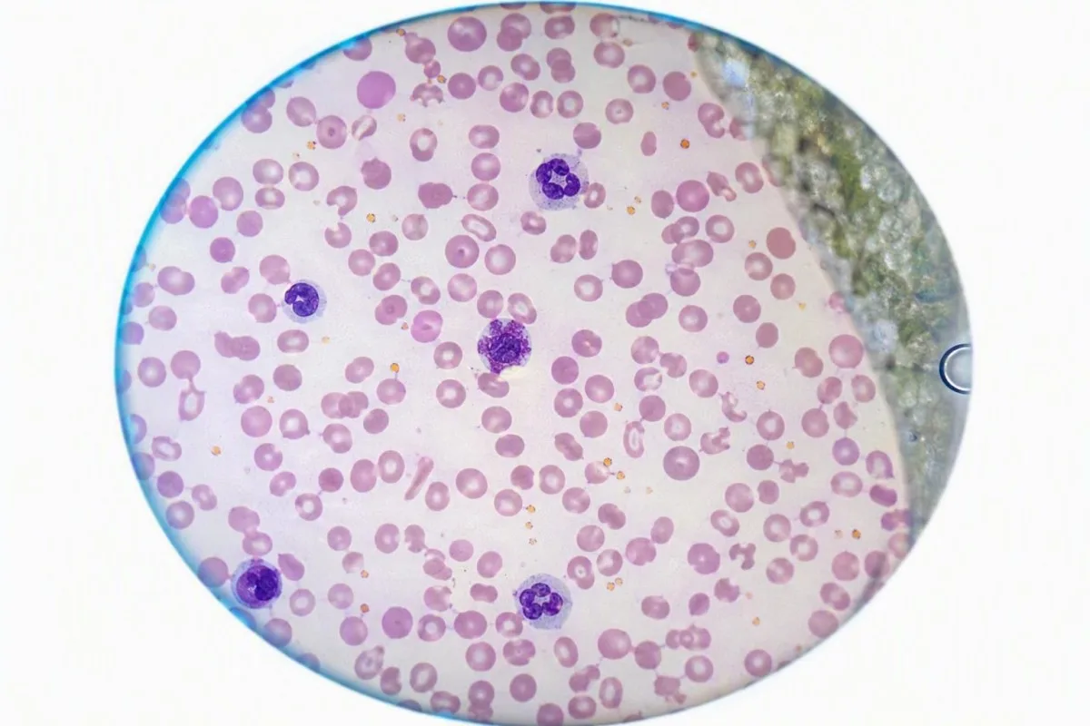 Escena de llista de verificació de preparació de mostres de laboratori per a resultats analisi de sang precisos dels canvis d’estat d’ànim