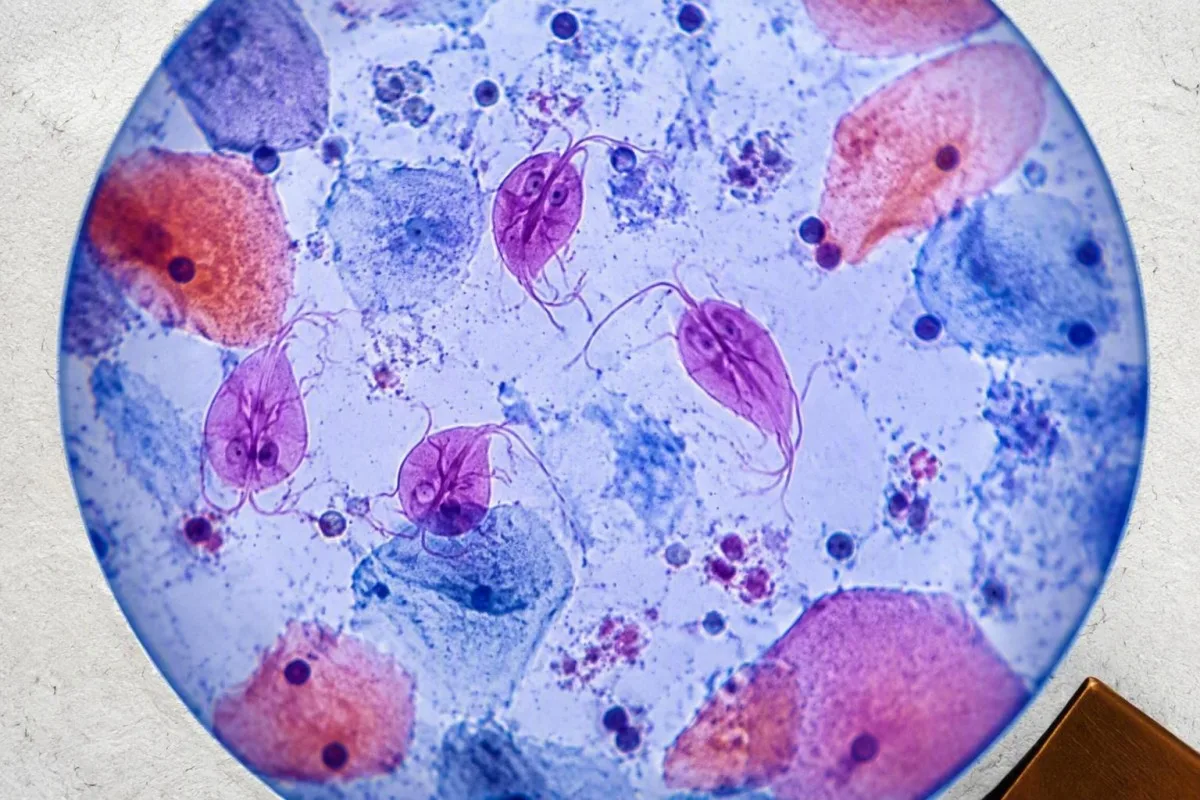 Proba de tricomoníase comparada con tubos de laboratorio de sangue de rutina e vial de mostra molecular